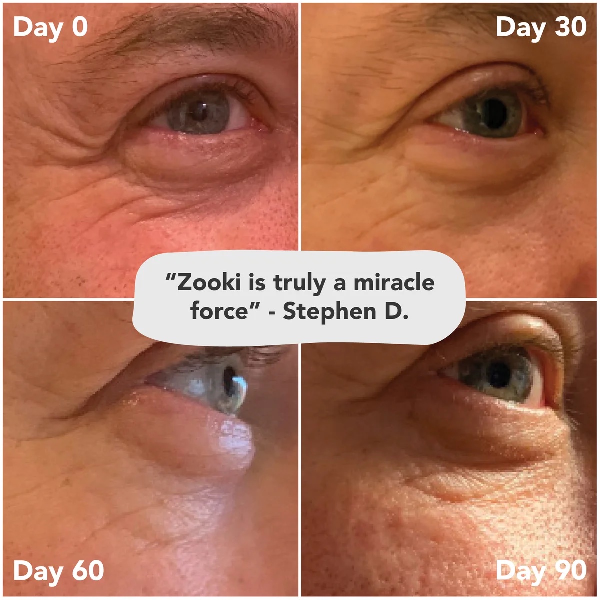 Zooki collagen 30 sachets variety pack - Image 2