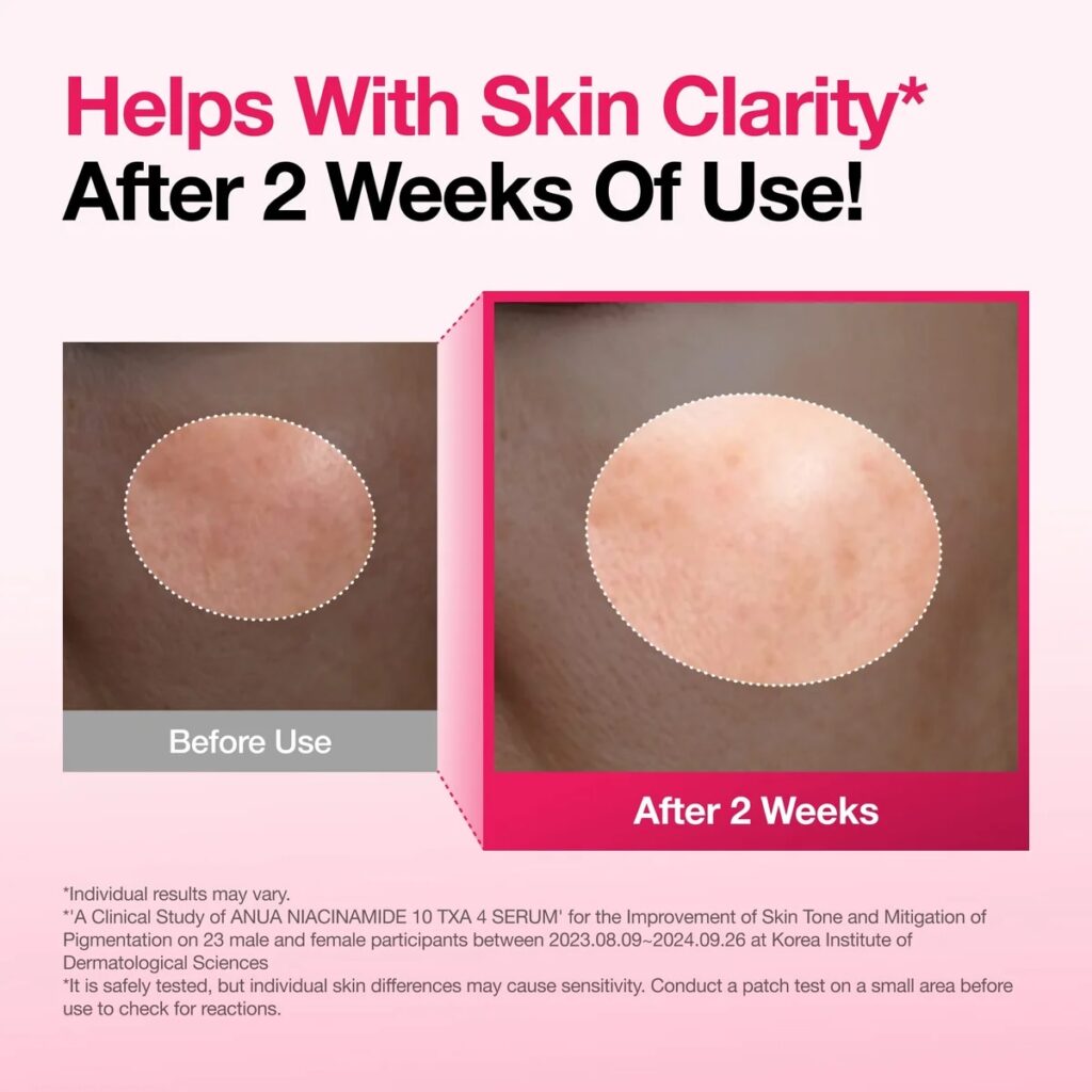 ANUA Niacinamide 10 TXA 4 Serum for Brightening and Dark Spots